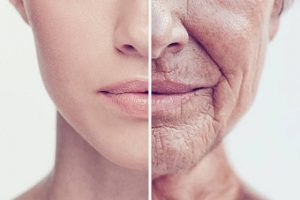 Aging Skin – The Different Kind of Indicators