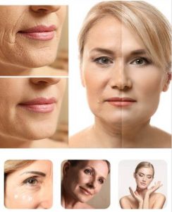 anti-aging, wrinkles